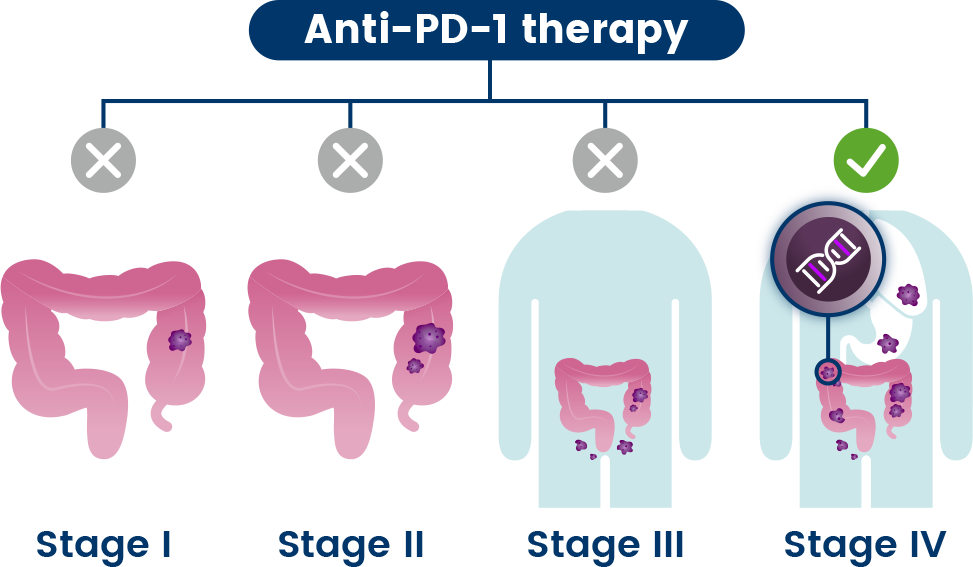 colon cancer anti pd-1 therapy