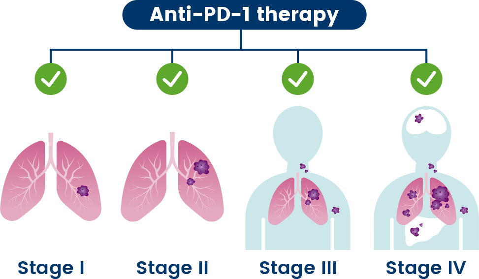 lung anti pd-1 therapy