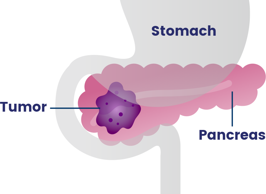 diagram of pancreas