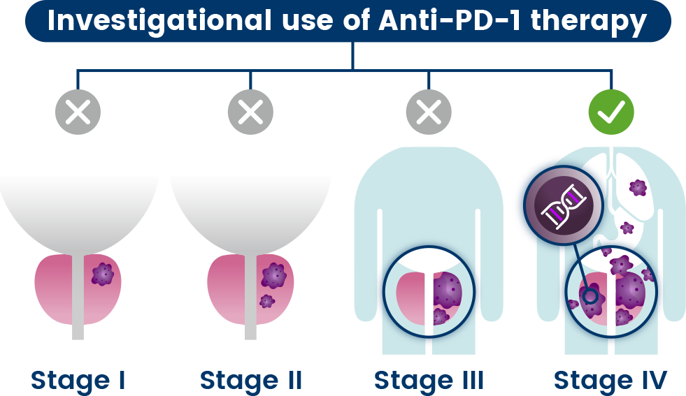 prostate anti pd 1 therapy