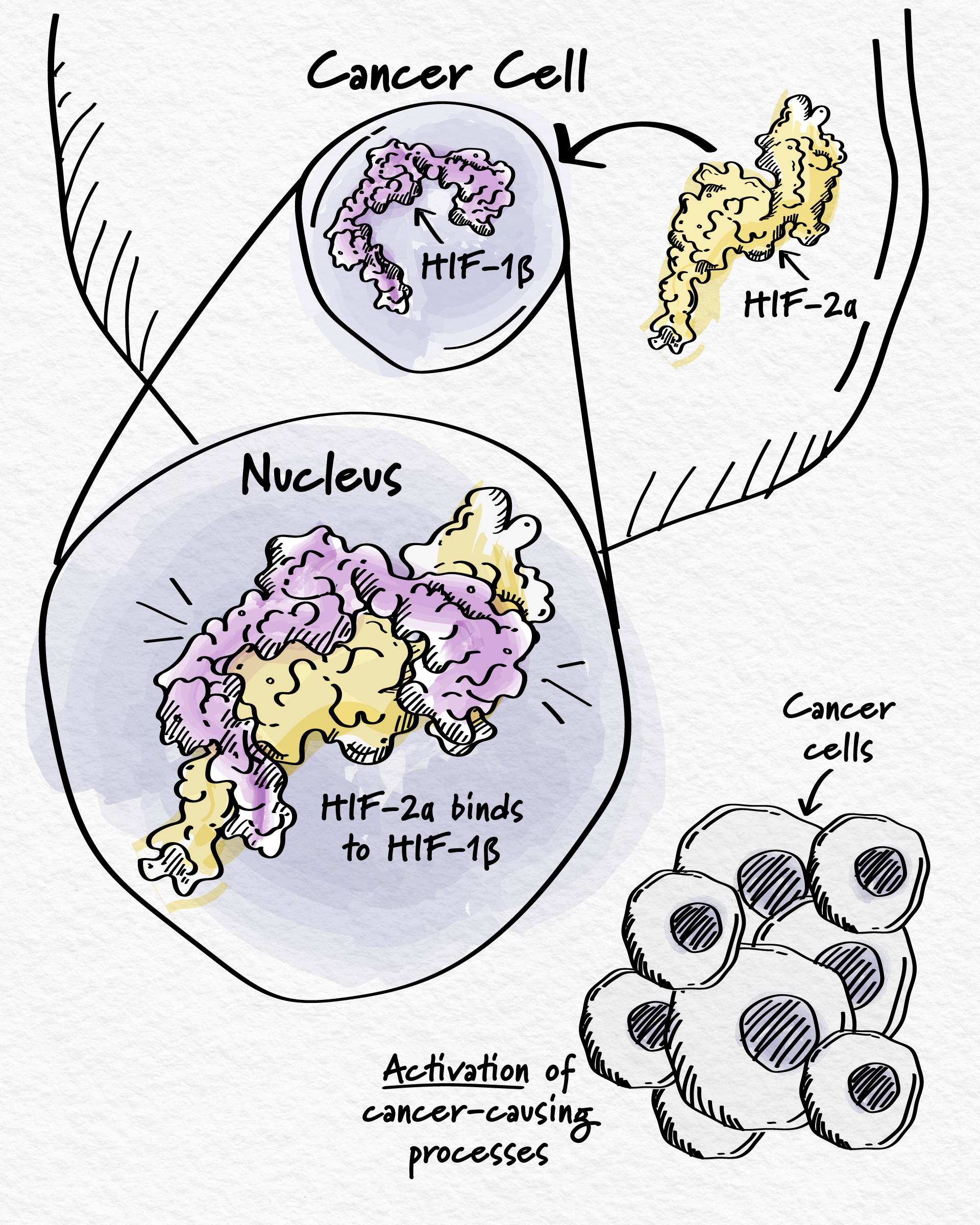 a diagram showing HIF-2α binding to HIF-1β inside the nucleus of a cancer cell, promoting the activation of cancer-causing processes